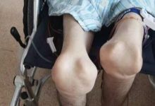 风暴眼丨骗保风波之后：一场“亡羊补牢”的困局-程序员中文网